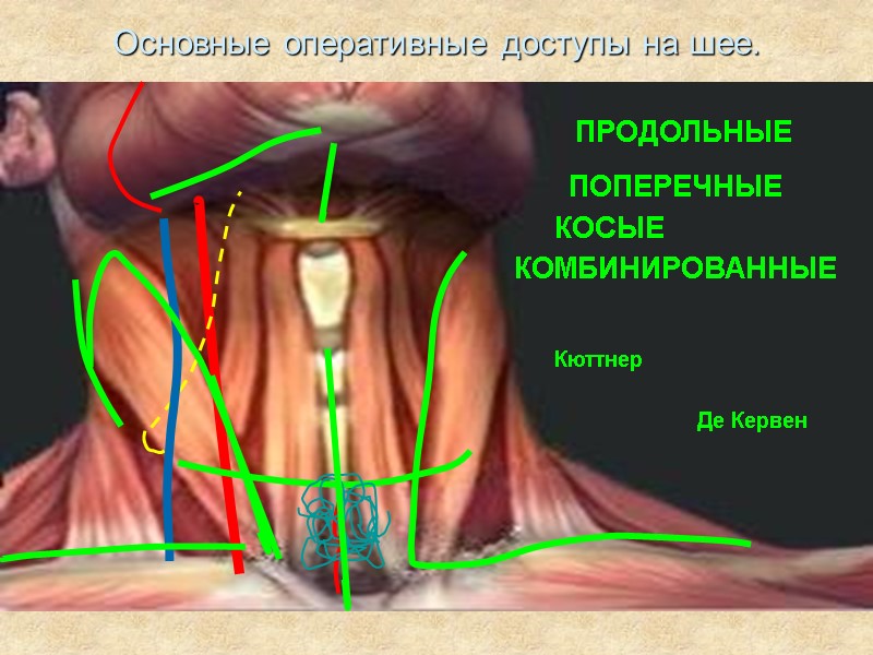 Основные оперативные доступы на шее. ПРОДОЛЬНЫЕ ПОПЕРЕЧНЫЕ КОСЫЕ КОМБИНИРОВАННЫЕ Кюттнер Де Кервен